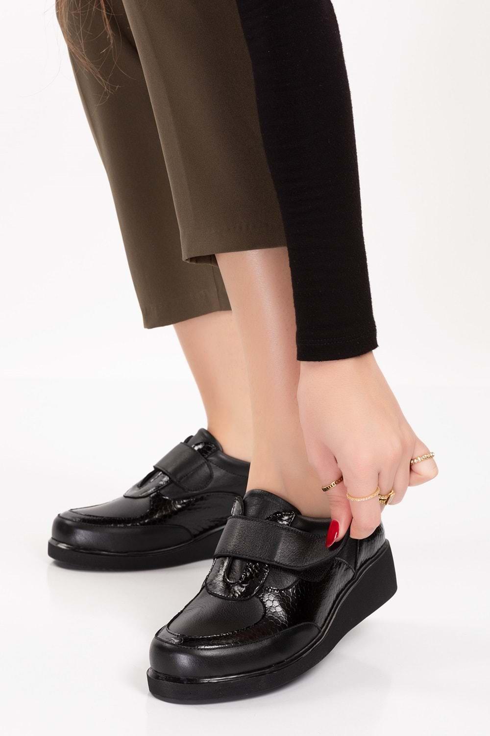 Gondol Hakiki Deri Anatomik Taban Cırtlı Kolay Giyim Ayakkabı tre.845 - Siyah - 40