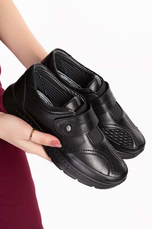 Gondol Hakiki Deri Kadın Kemik Çıkıntısına Özel Ayakkabı af.500 - Siyah - 36